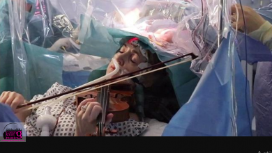 جراحی مغز با کمک ویولون در انگلیس